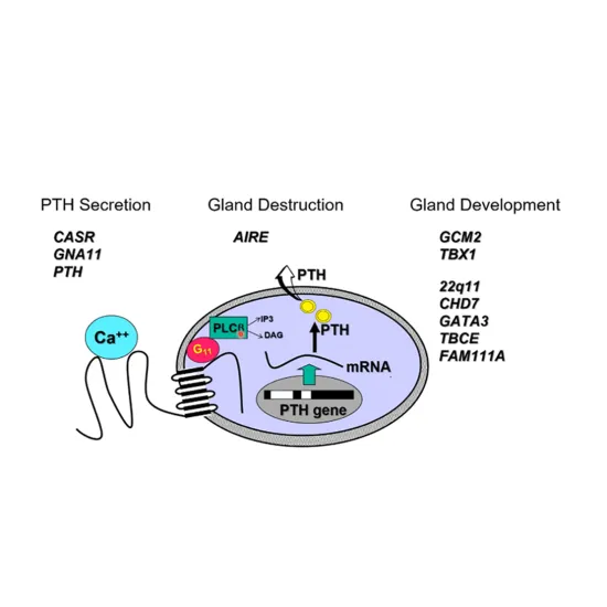 An idiopathic infographic highlighting the PTH secretion, gland destruction, and gland development.